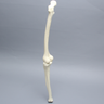 Knee with Two Collateral Ligaments and Narrow Intercondylar Notch, Full Length