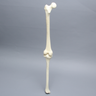 Knee with Two Collateral Ligaments and Narrow Intercondylar Notch, Full Length