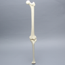 Knee with Two Collateral Ligaments and Narrow Intercondylar Notch, Full Length