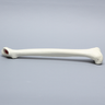 Femur with Broached Proximal Cavity
