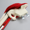 Hemi Pelvis with Erosion, Muscles, and Torn Labrum