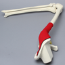 Hemi Pelvis, Encapsulated with Full Knee with Stretch Ligaments