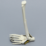 Foot and Ankle, with Clubfoot and Ligaments, Pediatric