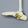 Foot and Ankle, with Clubfoot and Ligaments, Pediatric