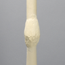Femur with Midshaft Malunion and Anteversion