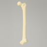 Femur with 20 Degree Distal Valgus Deformity