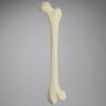 Femur with 25 Degree Distal Valgus Deformity
