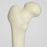 Femur with 30 Degree Deformity and Light Density Core, Large