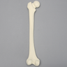 Femur with Slipped Capital Epiphysis