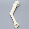 Tibia with Malunion and 20 Degree Procurvatum