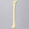 Tibia with Blount's Disease and Varus Deformities, Solid Foam