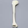 Tibia with Midshaft Malunion and Blount's Disease