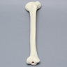Tibia with 30 Degrees Varus Defect