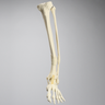 Foot and Ankle with Distal Malunion and Rotation