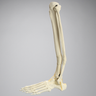 Foot and Ankle with Distal Malunion and Rotation