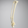 Foot and Ankle with Distal Malunion and Rotation