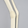 Tibia and Fibula with Malunions and 25º Varus Defect