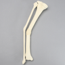 Tibia and Fibula with Malunions and 25º Varus Defect