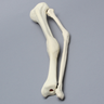 Tibia and Fibula with Malunions and 10º Varus Defect