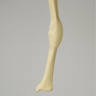 Tibia with Midshaft Malunion and 10º Varus Defect