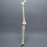 Knee with Fibula and Three Stretch Cord Ligaments, Full Length, Arthritic