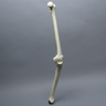 Knee with Fibula and Three Stretch Cord Ligaments, Full Length, Arthritic