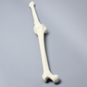 Knee with Three Stretch Tube Ligaments, Full Length, Arthritic