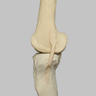 Knee with Three Stretch Tube Ligaments, Full Length, Arthritic