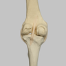 Knee with Three Stretch Tube Ligaments, Full Length, Arthritic