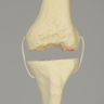 Knee with Revision Cuts and Stretch Cord Collateral Ligaments, Full Length