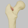 Knee with Revision Cuts and Stretch Cord Collateral Ligaments, Full Length