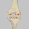 Knee with Revision Cuts and Stretch Cord Collateral Ligaments, Full Length