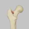 Knee with Revision Cuts and Stretch Cord Collateral Ligaments, Full Length