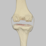 Knee with Revision Cuts and Stretch Cord Collateral Ligaments, Full Length
