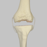 Knee with Revision Cuts and Stretch Cord Collateral Ligaments, Full Length