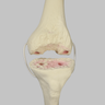 Knee with Revision Cuts and Stretch Cord Collateral Ligaments, Full Length
