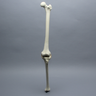 Knee with Three Stretch Tube Ligaments and Thicker Cortex, Full Length
