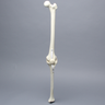 Knee with Patella, Narrow Intercondylar Notch, and Three Stretch Tube Ligaments, Full Length