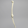Knee with Three Stretch Cord Ligaments and Narrow Intercondylar Notch, Full Length