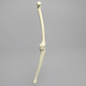 Knee with Three Stretch Cord Ligaments and Narrow Intercondylar Notch, Full Length