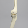 Knee with Three Stretch Cord Ligaments and Narrow Intercondylar Notch, Full Length