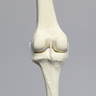 Knee with Three Stretch Cord Ligaments and Narrow Intercondylar Notch, Full Length