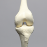 Knee with Three Stretch Cord Ligaments and Narrow Intercondylar Notch, Full Length