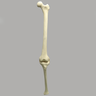 Knee with Three Stretch Tube Ligaments and Narrow Intercondylar Notch, Full Length, Left