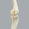 Knee with Three Stretch Tube Ligaments and Narrow Intercondylar Notch, Full Length, Left