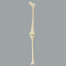 Knee with Three Nylon Non-Stretch Ligaments and Narrow Intercondylar Notch, Full Length