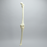 Knee with Unicondylar Fracture and Collateral Ligaments, Full Length