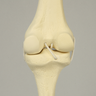 Knee with Four Stretch Cord Ligaments, Solid Foam, Right