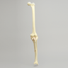 Knee with Bicondylar and Oblique Fractures of the Tibia, Full Length