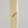 Knee with Bicondylar and Oblique Fractures of the Tibia, Full Length